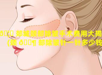 🦉 郯城颈部除皱手术费用大揭秘(颈 🐶 部除皱针一针多少钱)